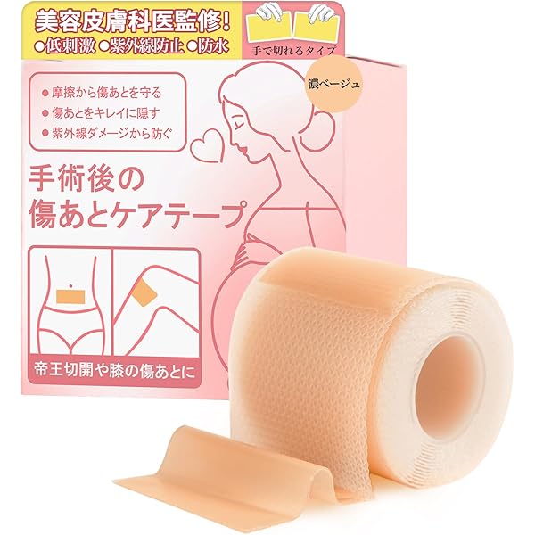 Amazon.co.jp: Totclear シリコン傷跡シート (1.6 x 12インチ